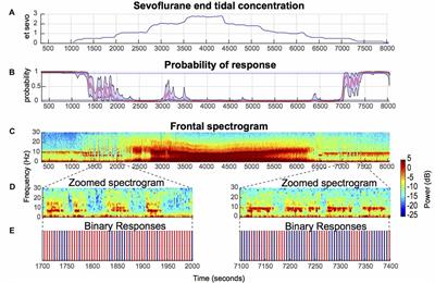 Lack of Responsiveness during the Onset and Offset of Sevoflurane Anesthesia Is Associated with Decreased Awake-Alpha Oscillation Power